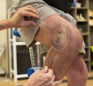 Post surgery rehabilitation